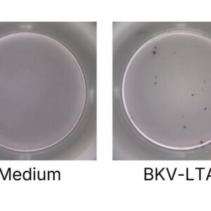 PepMix? BKV (large T antigen)